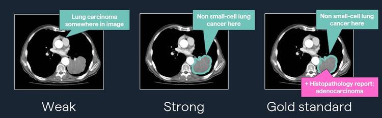 CT_Image_Labelling_levels.jpg